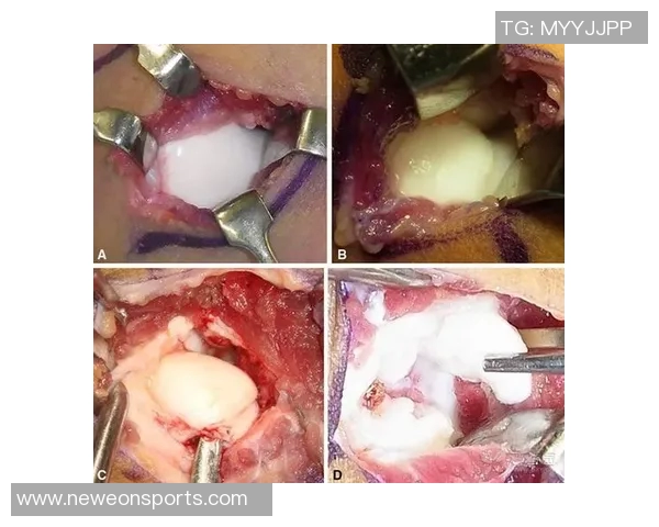 约维奇重摔受伤退场X光检查结果无异常明日将进行MRI检查评估伤情
